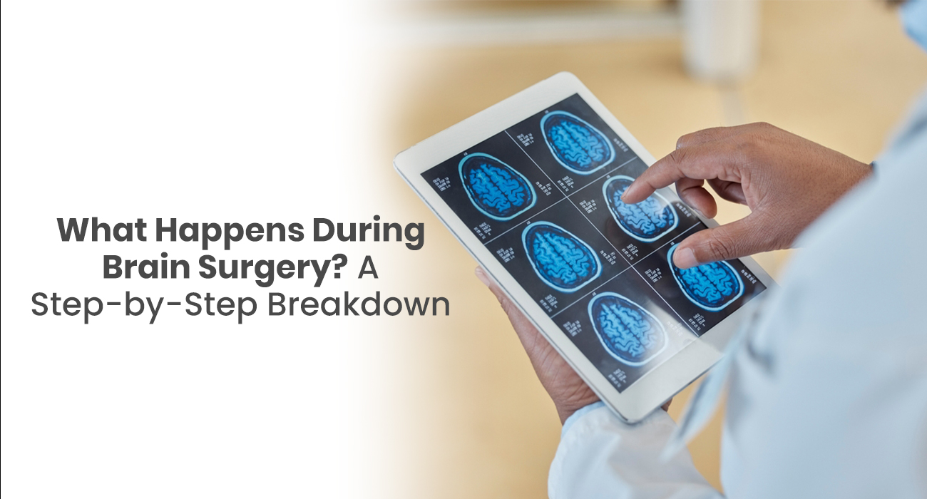 What Happens During Brain Surgery? A Step-by-Step Breakdown